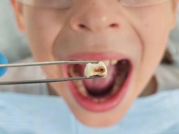 Best Emergency Pediatric Dentist  in Wolverine Lake, MI